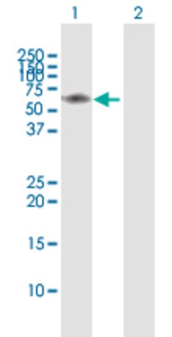 IRAK3, Rabbit anti-Human, Polyclonal Antibody, Abnova 100&mu;L; Unconjugated:Antibodies,