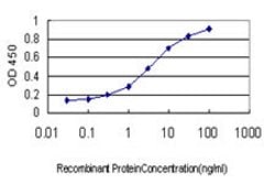 GALNT6, Mouse anti-Human, Clone: 4C10, Abnova 100 &mu;g | Buy Online | Abnova | Fisher Scientific
