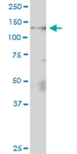 ZHX1, Rabbit anti-Human, Polyclonal Antibody, Abnova 100&mu;L; Unconjugated:Antibodies,