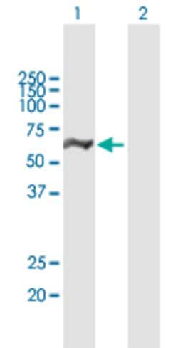 DDX19B, Mouse anti-Human, Polyclonal Antibody, Abnova 50&mu;g; Unconjugated:Antibodies,