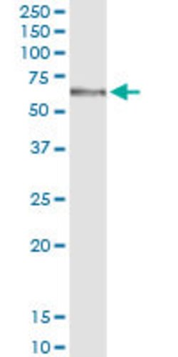 MGAT4B, Rabbit anti-Human, Polyclonal Antibody, Abnova 100&mu;L; Unconjugated:Antibodies,
