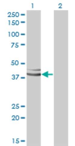 GPN1, Mouse anti-Human, Clone: 3E1, Abnova 100&mu;g; Unconjugated:Antibodies,