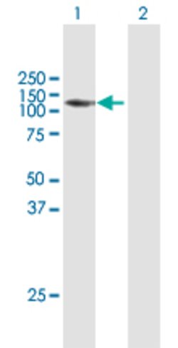 ZHX2, Rabbit anti-Human, Polyclonal Antibody, Abnova 100&mu;L; Unconjugated:Antibodies,