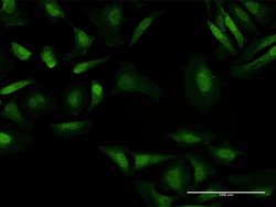 BAHD1, Mouse anti-Human, Polyclonal Antibody, Abnova 50&mu;g; Unconjugated:Antibodies,