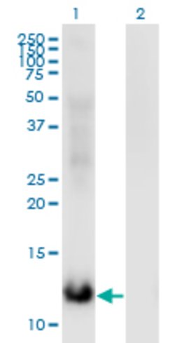 MSRB2, Mouse anti-Human, Clone: 3F12, Abnova 100&mu;g; Unconjugated:Antibodies,
