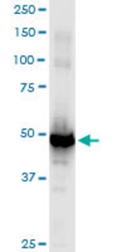 WAPAL, Rabbit anti-Human, Polyclonal Antibody, Abnova 100 &mu;L | Buy Online | Abnova | Fisher Scientific