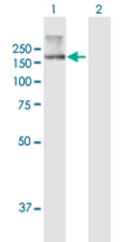 ATP10B, Mouse anti-Human, Polyclonal Antibody, Abnova 50&mu;g; Unconjugated:Antibodies,