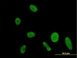 DIP2A, Mouse anti-Human, Polyclonal Antibody, Abnova 50&mu;g; Unconjugated:Anticuerpos