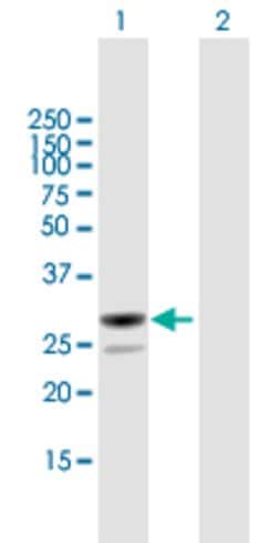 MESDC2, Mouse anti-Human, Polyclonal Antibody, Abnova 50 &mu;g | Buy Online | Abnova | Fisher Scientific