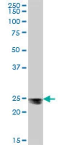 MESDC2, Mouse anti-Human, Polyclonal Antibody, Abnova 50 &mu;g | Buy Online | Abnova | Fisher Scientific