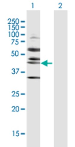 RRS1, Rabbit anti-Human, Polyclonal Antibody, Abnova 100&mu;g; Unconjugated:Antibodies,