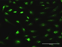 RRS1, Rabbit anti-Human, Polyclonal Antibody, Abnova 100&mu;g; Unconjugated:Antibodies,