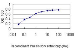 NCAPH, Mouse anti-Human, Clone: 1C9, Abnova 100&mu;g; Unconjugated:Antibodies,