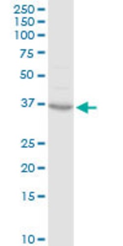 CCRK, Rabbit anti-Human, Polyclonal Antibody, Abnova 100 &mu;L | Buy Online | Abnova | Fisher Scientific