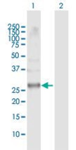 CCRK, Rabbit anti-Human, Polyclonal Antibody, Abnova 100 &mu;L | Buy Online | Abnova | Fisher Scientific