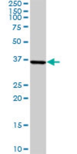 CCRK, Rabbit anti-Human, Polyclonal Antibody, Abnova 100 &mu;L | Buy Online | Abnova | Fisher Scientific