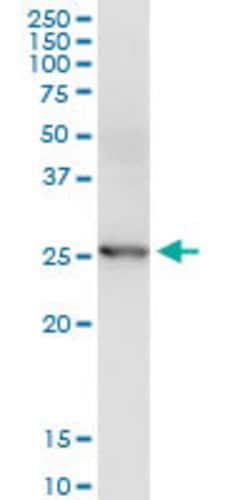 CCRK, Rabbit anti-Human, Polyclonal Antibody, Abnova 100 &mu;L | Buy Online | Abnova | Fisher Scientific