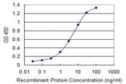 CCRK, Mouse anti-Human, Clone: 3E11, Abnova 100 &mu;g | Buy Online | Abnova | Fisher Scientific