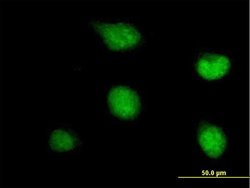 PATZ1, Mouse anti-Human, Polyclonal Antibody, Abnova 50&mu;g; Unconjugated:Antibodies,