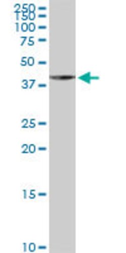 PLA2G15, Mouse anti-Human, Clone: 3B11, Abnova 100&mu;g; Unconjugated:Antikroppar