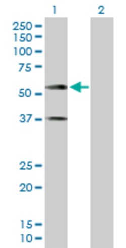 CADM1, Rabbit anti-Human, Polyclonal Antibody, Abnova 100&mu;g; Unconjugated:Antibodies,