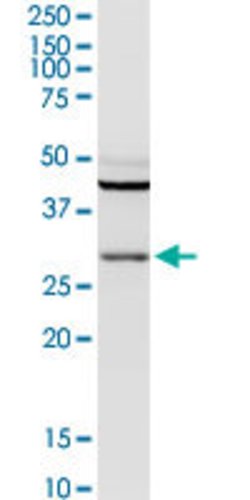 PGLS, Rabbit anti-Human, Polyclonal Antibody, Abnova 100&mu;g; Unconjugated:Antibodies,