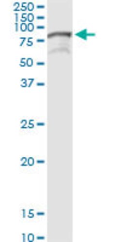TIAM2, Rabbit anti-Human, Polyclonal Antibody, Abnova 100&mu;L; Unconjugated:Antibodies,