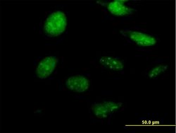 NKX2-8, Mouse anti-Human, Polyclonal Antibody, Abnova 50&mu;g; Unconjugated:Antibodies,