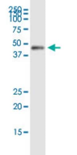 FBXO4, Rabbit anti-Human, Polyclonal Antibody, Abnova 100&mu;L; Unconjugated:Antibodies,