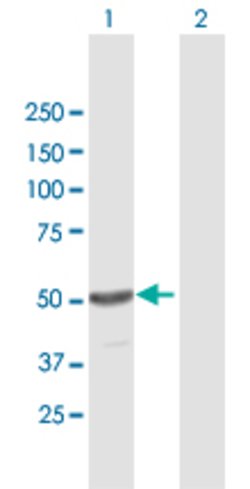 TINF2, Mouse anti-Human, Polyclonal Antibody, Abnova 50&mu;g; Unconjugated:Antibodies,