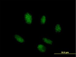 TINF2, Mouse anti-Human, Polyclonal Antibody, Abnova 50&mu;g; Unconjugated:Antibodies,