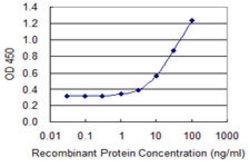TIMM8B, Mouse anti-Human, Clone: 8E5, Abnova 100&mu;g; Unconjugated:Antibodies,