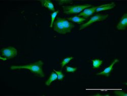 PABPC1, Rabbit anti-Human, Polyclonal Antibody, Abnova 100 &mu;g | Buy Online | Abnova | Fisher Scientific