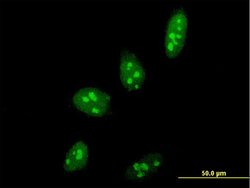 PELP1, Mouse anti-Human, Clone: 4F3, Abnova 100 &mu;g | Buy Online | Abnova | Fisher Scientific