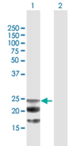 NAAA, Mouse anti-Human, Polyclonal Antibody, Abnova 50 &mu;g | Buy Online | Abnova | Fisher Scientific