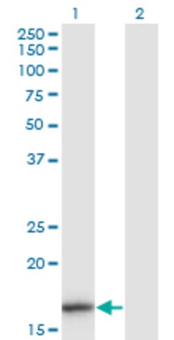 IL1F8, Mouse anti-Human, Clone: 1E4, Abnova 100&mu;g; Unconjugated:Antibodies,
