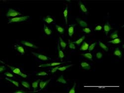 IL17C, Rabbit anti-Human, Polyclonal Antibody, Abnova 100 &mu;g | Buy Online | Abnova | Fisher Scientific