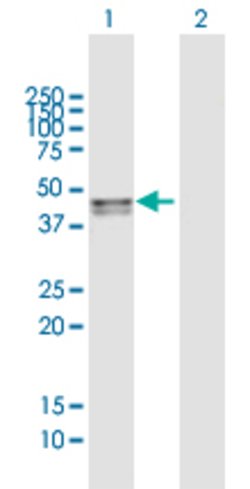 SMPDL3B, Mouse anti-Human, Polyclonal Antibody, Abnova 50&mu;g; Unconjugated:Antibodies,