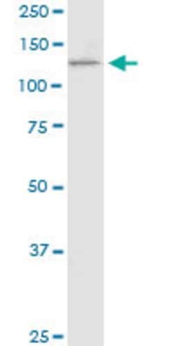 PCDH11X, Mouse anti-Human, Clone: 7B4, Abnova 50 &mu;g | Buy Online | Abnova | Fisher Scientific
