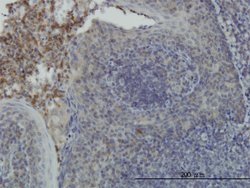 RPS6KA6, Mouse anti-Human, Clone: 8H5, Abnova 100&mu;g; Unconjugated:Antibodies,