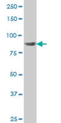 RPS6KA6, Mouse anti-Human, Clone: 8D2, Abnova 100&mu;g; Unconjugated:Antibodies,