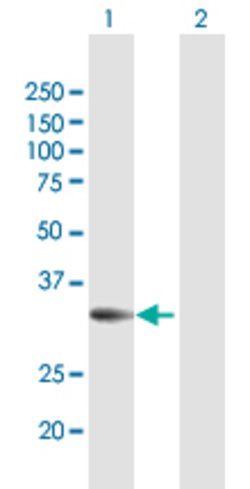 PPP2R3B, Rabbit anti-Human, Polyclonal Antibody, Abnova 100&mu;g; Unconjugated:Antibodies,