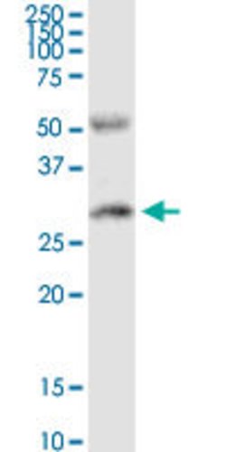 PPP2R3B, Rabbit anti-Human, Polyclonal Antibody, Abnova 100&mu;g; Unconjugated:Antibodies,