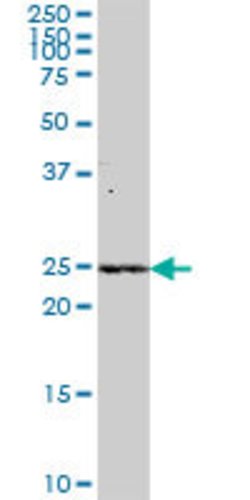 METTL11A, Mouse anti-Human, Polyclonal Antibody, Abnova 50&mu;g; Unconjugated:Antibodies,