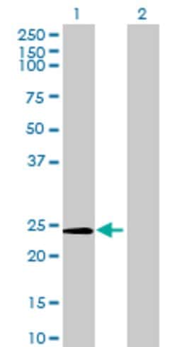 METTL5, Mouse anti-Human, Polyclonal Antibody, Abnova™