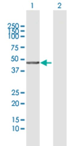 DNMT3L, Rabbit anti-Human, Polyclonal Antibody, Abnova 100&mu;L; Unconjugated:Antibodies,