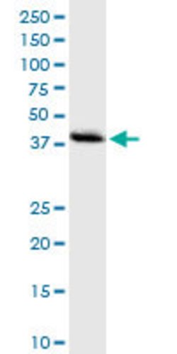 DNMT3L, Rabbit anti-Human, Polyclonal Antibody, Abnova 100&mu;L; Unconjugated:Antibodies,