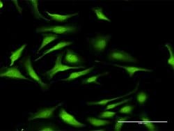 DNMT3L, Rabbit anti-Human, Polyclonal Antibody, Abnova 100&mu;L; Unconjugated:Antibodies,