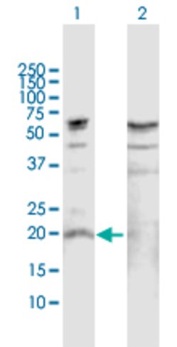 IL19, Rabbit anti-Human, Polyclonal Antibody, Abnova 100&mu;g; Unconjugated:Antibodies,