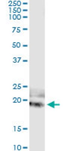 IL20, Mouse anti-Human, Clone: 2H8, Abnova 100&mu;g; Unconjugated:Anticuerpos